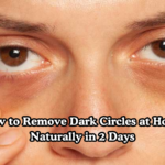 How-to-Remove-Dark-Circles-at-Home-Naturally-in-2-Days