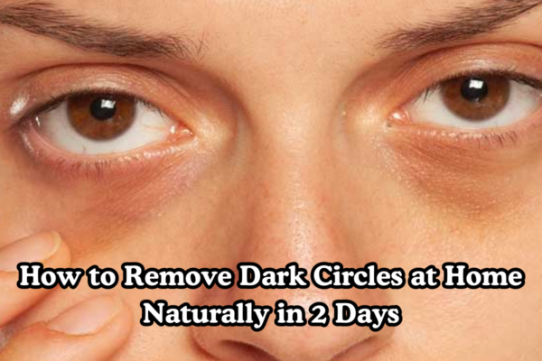 How-to-Remove-Dark-Circles-at-Home-Naturally-in-2-Days